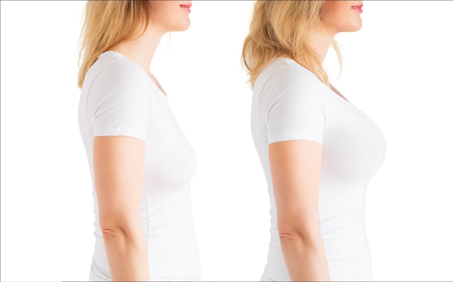 How Much Does an AirSculpt Breast Fat Transfer Cost?